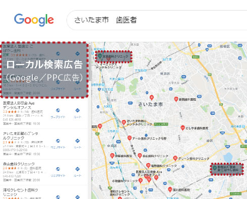 ローカル検索広告（Google／PPC広告）
